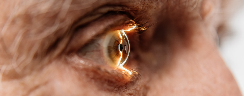 Diabetic Eye Disease