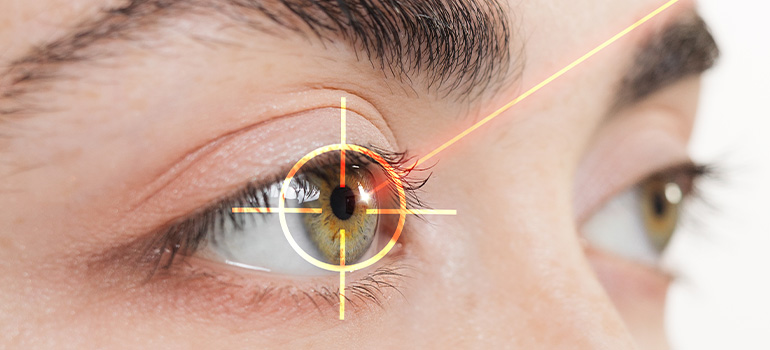 lasik
